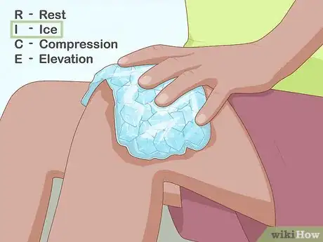 Image intitulée Treat Quadriceps Tendonitis Step 3