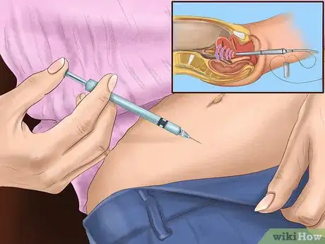 Image intitulée Prepare for in Vitro Fertilization Step 1
