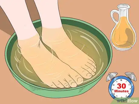 Image intitulée Fix Thick Toenails Step 8