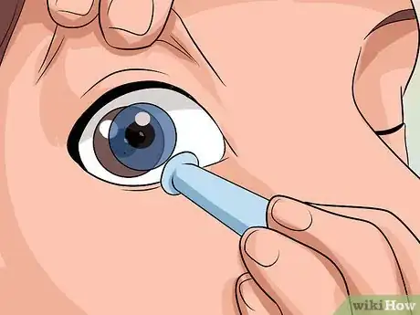Image intitulée Remove Stuck Contact Lenses Step 13