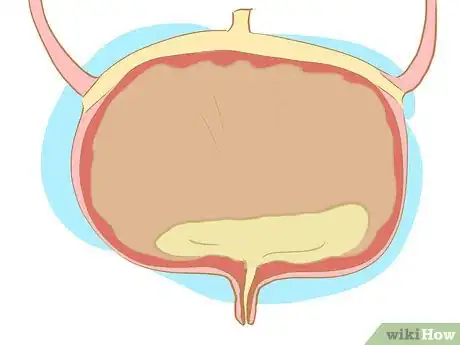 Image intitulée Manage Urinary Incontinence in Children Step 5