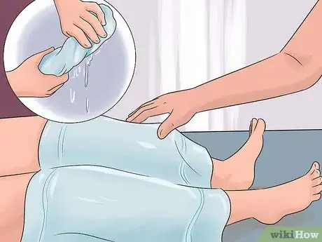 Image intitulée Treat a Burn Step 17