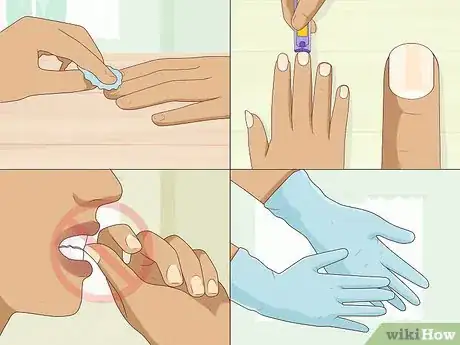 Image intitulée Stop Itchy Cuticles Step 7