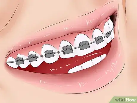 Image intitulée Get Rid of a Speech Disorder Step 11