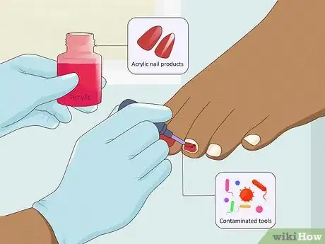 Image intitulée Stop Itchy Cuticles Step 3