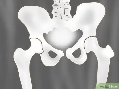 Image intitulée Manage Urinary Incontinence in Children Step 20