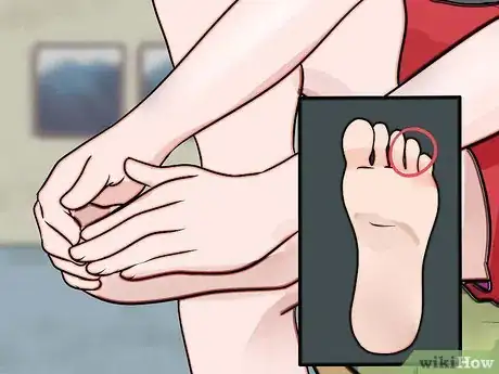 Image intitulée Sleep with Carpal Tunnel Syndrome While Pregnant Step 10