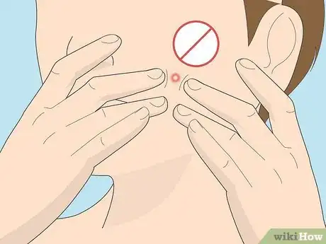 Image intitulée Get Rid of a Pimple Using Toothpaste Step 19