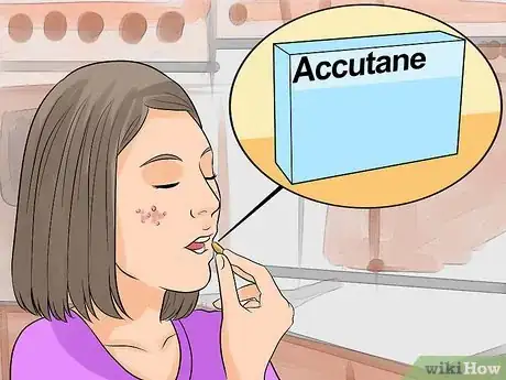 Image intitulée Deal With Pimples Step 17