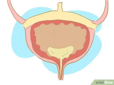 Image intitulée Manage Urinary Incontinence in Children Step 3