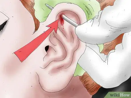 Image intitulée Get an Industrial Piercing Step 13.jpeg