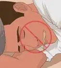 soigner votre langue après vous être mordu