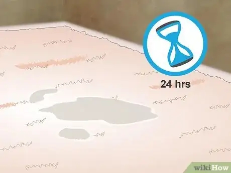 Image intitulée Get Hair Dye Out of a Carpet Step 12