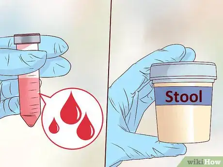 Image intitulée Test for Botulism Step 10