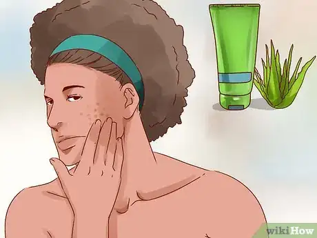 Image intitulée Get Rid of Acne Scars Naturally Step 4
