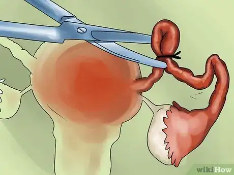 Image intitulée Not Get Pregnant Step 12