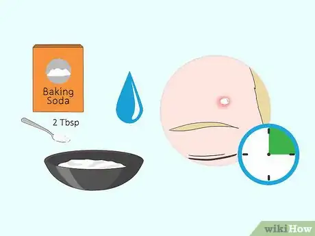 Image intitulée Shrink Pimples Step 5