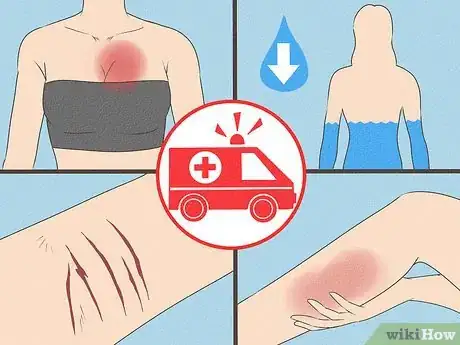 Image intitulée Beat Anorexia Step 1