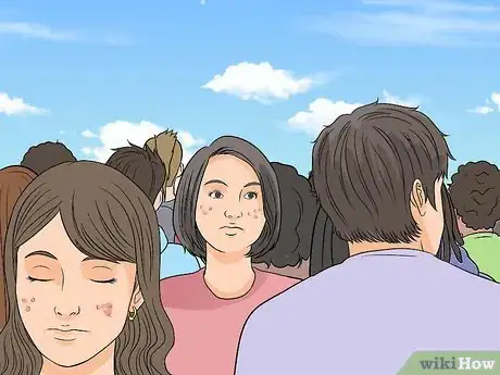 Image intitulée Deal With Pimples Step 2