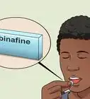 traiter la teigne