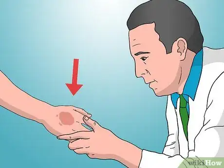 Image intitulée Treat Electrical Burns Step 25