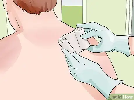 Image intitulée Get Rid of a Sunburn Step 8