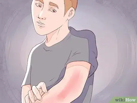 Image intitulée Differentiate Between Malaria, Dengue, and Chikungunya Step 16