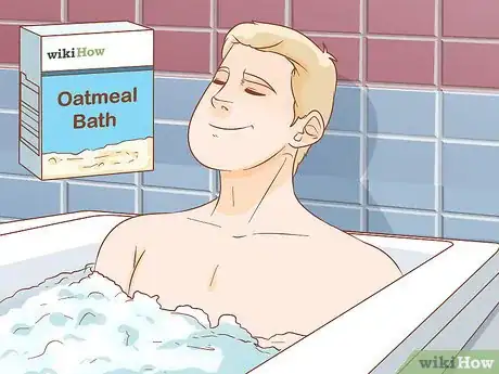 Image intitulée Get Rid of Poison Ivy Rashes Step 10