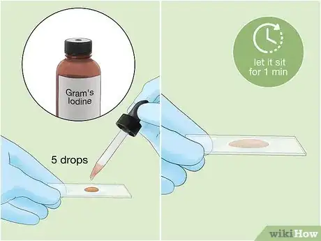 Image intitulée Identify Bacteria Step 6