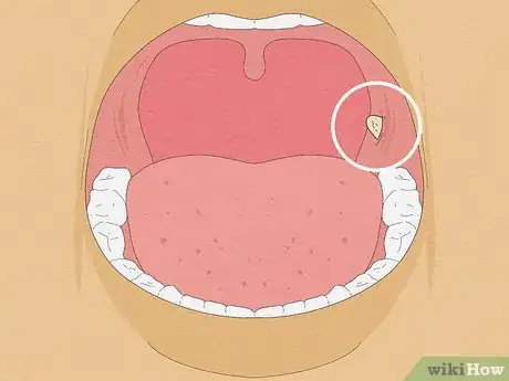 Image intitulée Fix Bad Breath on the Spot Step 16