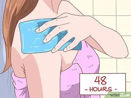 Image intitulée Treat a Pulled Oblique Muscle Step 2
