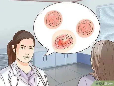 Image intitulée Treat Skin Cancer Step 5