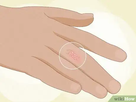 Image intitulée Find a Caterpillar Step 13