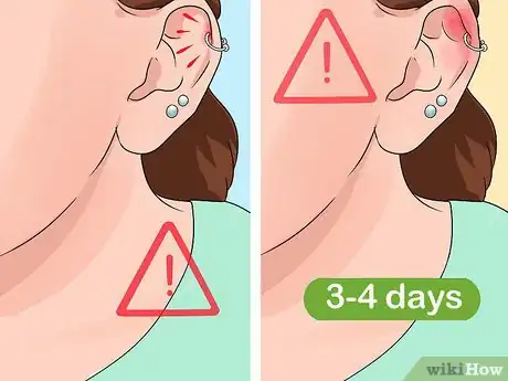 Image intitulée Clean a Cartilage Piercing Step 10