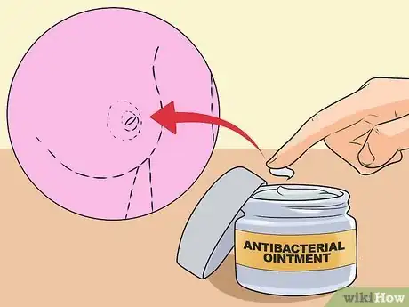 Image intitulée Heal a Cracked Nipple when Breastfeeding Step 3