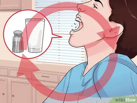 Image intitulée Treat Tongue Burn Blisters Step 5
