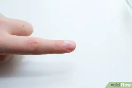 Image intitulée Fix a Broken Fingernail Step 22