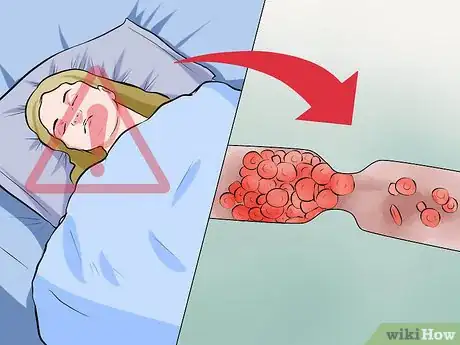 Image intitulée Deal With Pre Eclampsia Step 10