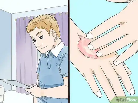 Image intitulée Kill Fungus Step 3