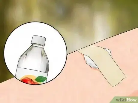 Image intitulée Get Rid of Bug Bites Step 9