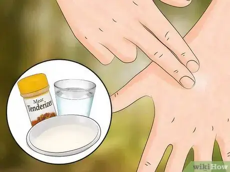 Image intitulée Get Rid of Bug Bites Step 6