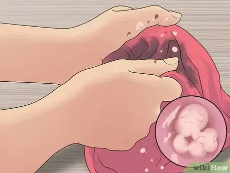 Image intitulée Wash Baby Clothes Step 10