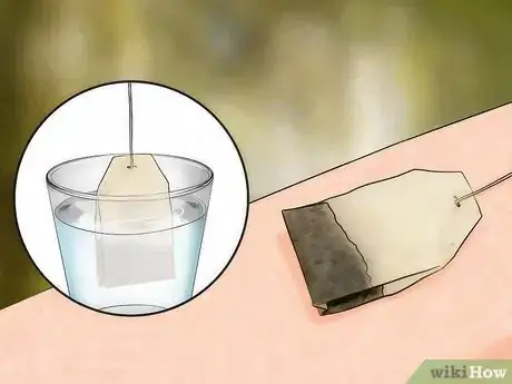 Image intitulée Get Rid of Bug Bites Step 7