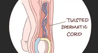 traiter des douleurs et une inflammation des testicules