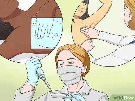 Image intitulée Know if You Have Breast Cancer Step 1