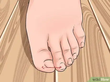 Image intitulée Avoid Ingrown Toenails Step 2