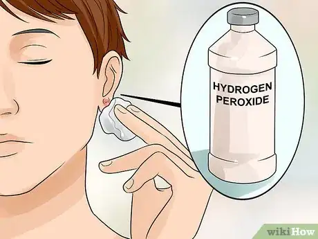 Image intitulée Get Rid of Pimples Inside the Ear Step 7