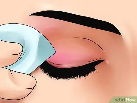 Image intitulée Reduce Bags Under Your Eyes Step 1
