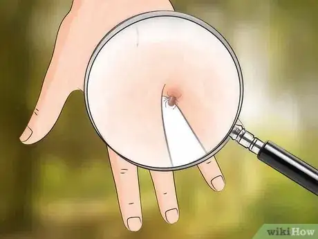 Image intitulée Get Rid of Bug Bites Step 13