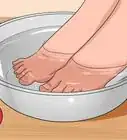 se débarrasser des ongles incarnés